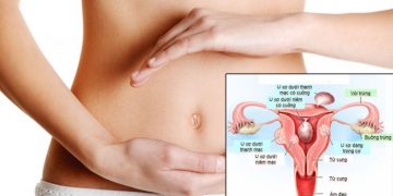 Bị đau bụng dưới là gì? Nguyên nhân gây đau vùng bụng dưới