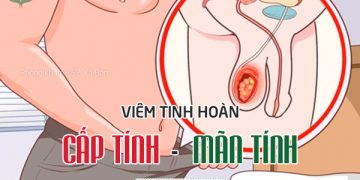 Viêm tinh hoàn: nguyên nhân, triệu chứng và cách điều trị