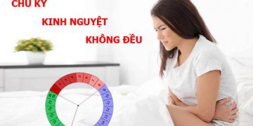 Kinh nguyệt không đều: nguyên nhân và cách điều trị