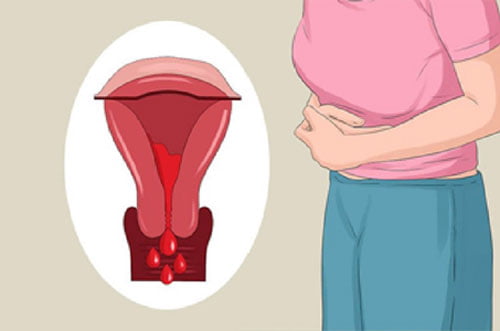 Rong kinh là gì? nguyên nhân, triệu chứng & cách điều trị