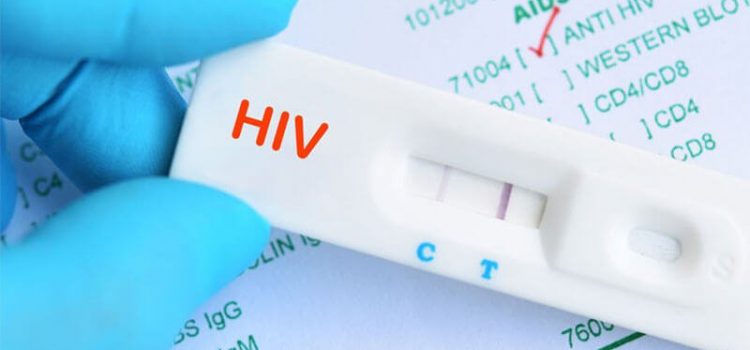 Khi nào cần test HIV sớm?